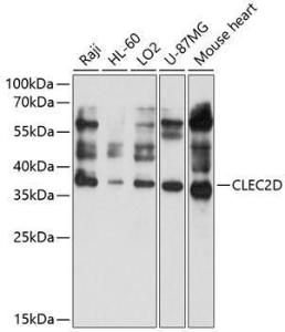 Western blot analysis of extracts of various cell lines, using Anti-CLEC2D Antibody (A11310) at 1:1,000 dilution. The secondary antibody was Goat Anti-Rabbit IgG H&L Antibody (HRP) at 1:10,000 dilution.