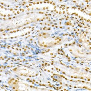 Immunohistochemistry analysis of paraffin-embedded rat kidney using Anti-SMAD5 (phospho Ser463 + Ser465) Antibody (A308813) at a dilution of 1:50 (40X lens). Perform high pressure antigen retrieval with 10 mM citrate buffer pH 6.0 before commencing with IHC staining protocol