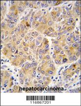 Anti-ALDH9A1 Rabbit Polyclonal Antibody