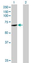 Anti-CYP11B1 Rabbit Polyclonal Antibody