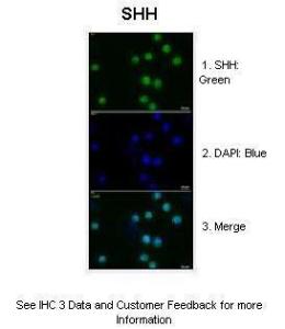 Anti-SHH Rabbit Polyclonal Antibody