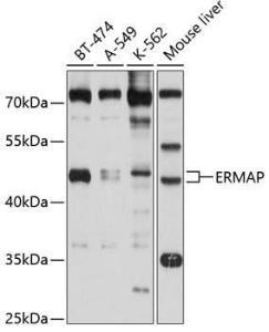 Anti-ERMAP Antibody (A11311)