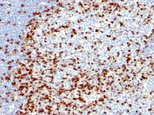 Immunohistochemical analysis of formalin-fixed, paraffin-embedded human tonsil using Anti-ZAP70 Antibody [ZAP70/528 + 2F3.2]