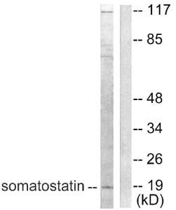 Western blot analysis of lysates from A549 cells using Anti-Somatostatin Antibody. The right hand lane represents a negative control, where the antibody is blocked by the immunising peptide