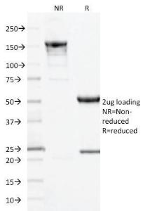 Anti-CD10 Mouse Monoclonal Antibody [clone: MME/1893]