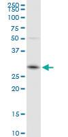 Anti-GSTO1 Rabbit Polyclonal Antibody