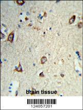 Anti-HS3ST2 Rabbit Polyclonal Antibody (FITC (Fluorescein Isothiocyanate))