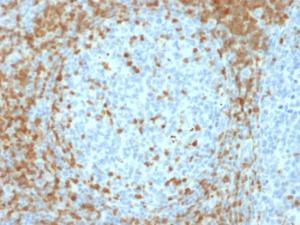 Anti-ZAP70 antibody