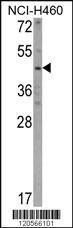 Anti-KYNU Rabbit Polyclonal Antibody