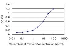 Anti-CYP19A1 Mouse Monoclonal Antibody [clone: 2B6]