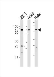 Anti-HSF2 Rabbit Polyclonal Antibody (FITC (Fluorescein Isothiocyanate))