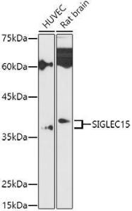 Western blot analysis of extracts of various cell lines, using Anti-SIGLEC15 Antibody (A305933) at 1:1,000 dilution