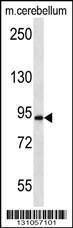 Anti-APBA2 Rabbit Polyclonal Antibody (Biotin)