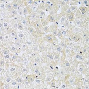 Immunohistochemistry analysis of paraffin-embedded rat liver using Anti-SLC4A5 Antibody (A11313) at a dilution of 1:100 (40x lens). Perform microwave antigen retrieval with 10 mM PBS buffer pH 7.2 before commencing with IHC staining protocol.