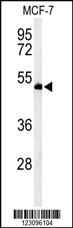 Anti-RUVBL1 Rabbit Polyclonal Antibody