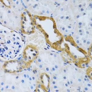 Immunohistochemistry analysis of paraffin-embedded rat kidney using Anti-SLC4A5 Antibody (A11313) at a dilution of 1:100 (40x lens). Perform microwave antigen retrieval with 10 mM PBS buffer pH 7.2 before commencing with IHC staining protocol.