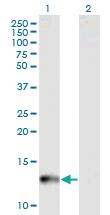 Anti-CYP24A1 Mouse Monoclonal Antibody [clone: 1F8]