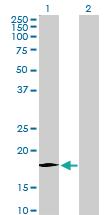 Anti-CCL11 Rabbit Polyclonal Antibody