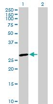 Anti-GSTO1 Rabbit Polyclonal Antibody