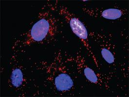 Anti-SYK Antibody Pair