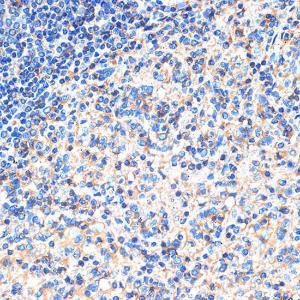 Immunohistochemistry analysis of paraffin-embedded human spleen using Anti-SIGLEC15 Antibody (A305933) at a dilution of 1:100 (40X lens). Perform microwave antigen retrieval with 10 mM Tris/EDTA buffer pH 9.0 before commencing with IHC staining protocol