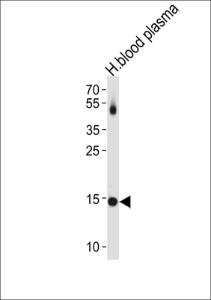 Anti-Prealbumin Rabbit Polyclonal Antibody (APC (Allophycocyanin))