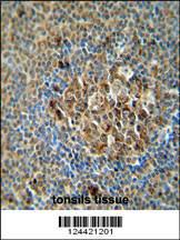 Anti-ACSF3 Rabbit Polyclonal Antibody (HRP (Horseradish Peroxidase))