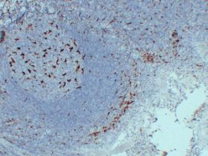 Immunohistochemical analysis of paraffin-embedded human Tonsil using Anti-CD68 Antibody