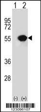 Anti-RUVBL1 Rabbit Polyclonal Antibody