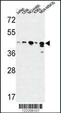 Anti-ADH7 Rabbit Polyclonal Antibody