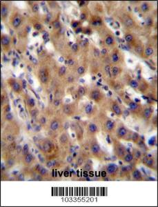 Anti-SRPK1 Rabbit Polyclonal Antibody (Biotin)