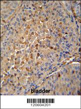 Anti-MAPRE1 Rabbit Polyclonal Antibody