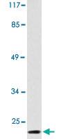 Anti-CD83 Rabbit Polyclonal Antibody