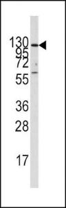 Anti-IDE Rabbit Polyclonal Antibody (APC (Allophycocyanin))