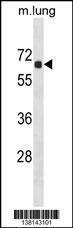 Anti-ACOT9 Rabbit Polyclonal Antibody (PE (Phycoerythrin))