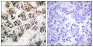 Immunohistochemical analysis of paraffin-embedded human brain using Anti-Histone H3.3 Antibody. The right hand panel represents a negative control, where the antibody was pre-incubated with the immunising peptide.