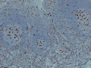 Immunohistochemical analysis of paraffin-embedded human Tonsil using Anti-CD68 Antibody