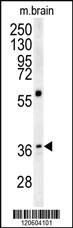 Anti-DCTN4 Rabbit Polyclonal Antibody