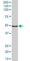 Anti-CYP27A1 Mouse Polyclonal Antibody