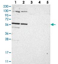 Anti-CCDC181 Rabbit Polyclonal Antibody