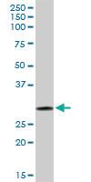 Anti-GSTO1 Rabbit Polyclonal Antibody