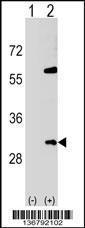 Anti-SNF8 Rabbit Polyclonal Antibody (Biotin)