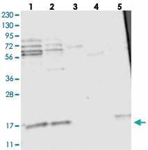 Anti-C11ORF87 Rabbit Polyclonal Antibody