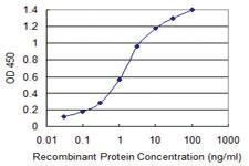 Anti-CERS4 Mouse Monoclonal Antibody [clone: 2G6]