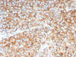 Anti-SERBP1 Mouse Monoclonal Antibody [clone: SERBP1/3492]