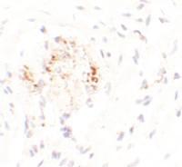 Anti-LEMD3 Rabbit Polyclonal Antibody