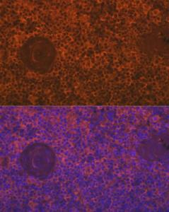 Immunofluorescence analysis of human spleen cells using Anti-SIGLEC15 Antibody (A305933) at a dilution of 1:100 (40X lens). DAPI was used to stain the cell nuclei (blue)