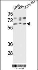 Anti-ACHE Rabbit Polyclonal Antibody