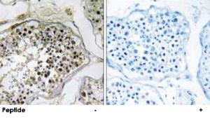 Anti-ELOVL2 Rabbit Polyclonal Antibody