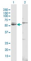 Anti-CYP51A1 Rabbit Polyclonal Antibody